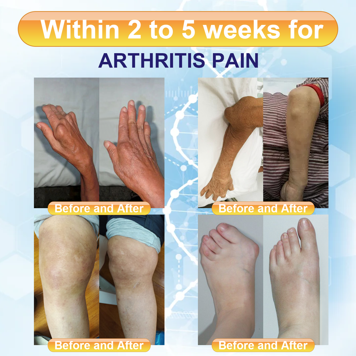 𝐃𝐢𝐚𝐩𝐚𝐬𝐨𝐧™ 𝟗𝟖% 𝐁𝐞𝐞 𝐕𝐞𝐧𝐨𝐦 𝐏𝐚𝐢𝐧 & 𝐉𝐨𝐢𝐧𝐭 𝐓𝐡𝐞𝐫𝐚𝐩𝐲 𝐏𝐚𝐭𝐜𝐡