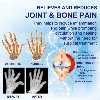 𝐃𝐢𝐚𝐩𝐚𝐬𝐨𝐧™ 𝟗𝟖% 𝐁𝐞𝐞 𝐕𝐞𝐧𝐨𝐦 𝐏𝐚𝐢𝐧 & 𝐉𝐨𝐢𝐧𝐭 𝐓𝐡𝐞𝐫𝐚𝐩𝐲 𝐏𝐚𝐭𝐜𝐡